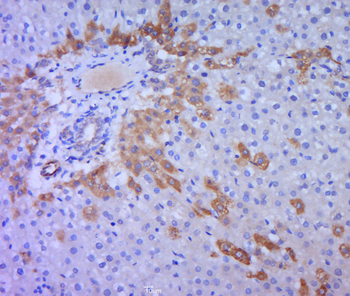 SHBG Rabbit Polyclonal Antibody