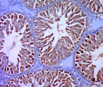 SHBG Rabbit Polyclonal Antibody