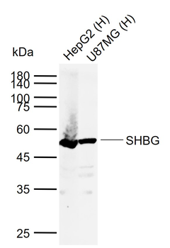 SHBG Rabbit Polyclonal Antibody