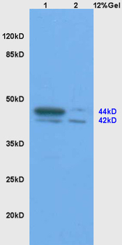 SHBG Rabbit Polyclonal Antibody