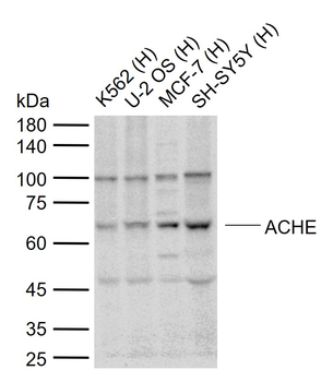 ACHE Rabbit Polyclonal Antibody