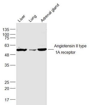Angiotensin II type 1A receptor Rabbit Polyclonal Antibody
