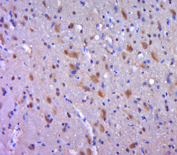 AIMP2 Rabbit Polyclonal Antibody