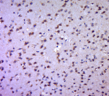 Aldolase A Rabbit Polyclonal Antibody