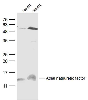 Atrial natriuretic factor Rabbit Polyclonal Antibody