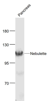 Nebulette Rabbit Polyclonal Antibody