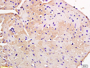 Nebulette Rabbit Polyclonal Antibody