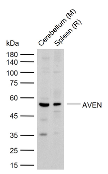 AVEN Rabbit Polyclonal Antibody