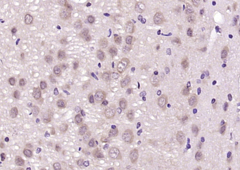 Dishevelled 3 Rabbit Polyclonal Antibody