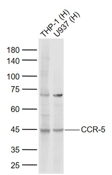 CCR5 Rabbit Polyclonal Antibody