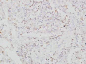 IL2 Receptor beta Rabbit Polyclonal Antibody