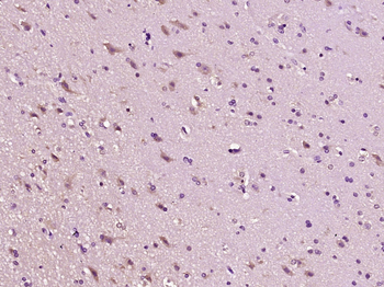 CD30 Rabbit Polyclonal Antibody