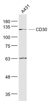 CD30 Rabbit Polyclonal Antibody