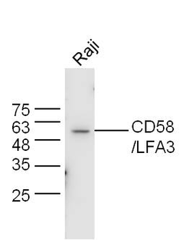 CD58 Rabbit Polyclonal Antibody