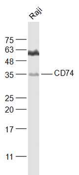 CD74 Rabbit Polyclonal Antibody