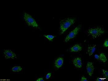 CK7 Rabbit Polyclonal Antibody