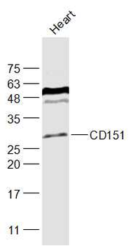 CD151 Rabbit Polyclonal Antibody