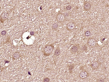 Dopamine D3 receptor Rabbit Polyclonal Antibody