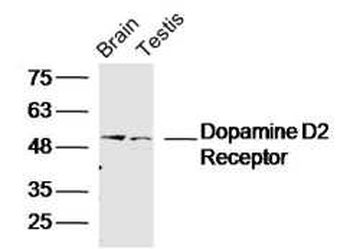 Dopamine D5 receptor Rabbit Polyclonal Antibody