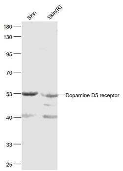 Dopamine D5 receptor Rabbit Polyclonal Antibody