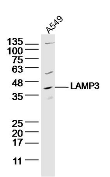 LAMP3 Rabbit Polyclonal Antibody