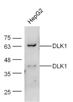 DLK1 Rabbit Polyclonal Antibody