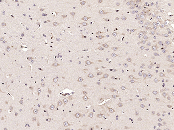 ECE2 Rabbit Polyclonal Antibody