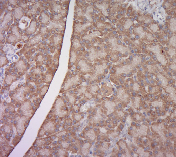 EAR1 Rabbit Polyclonal Antibody