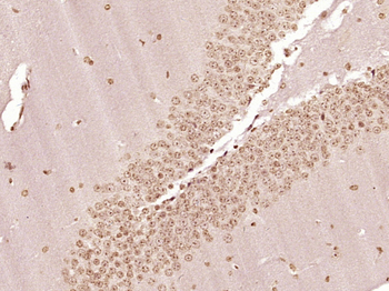 Phospho-eIF4E (Ser209) Rabbit Polyclonal Antibody