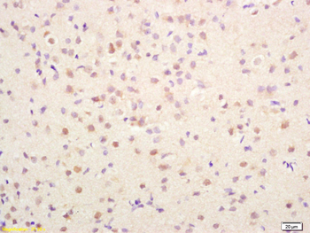 PRKAG2 Rabbit Polyclonal Antibody