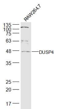 DUSP4 Rabbit Polyclonal Antibody