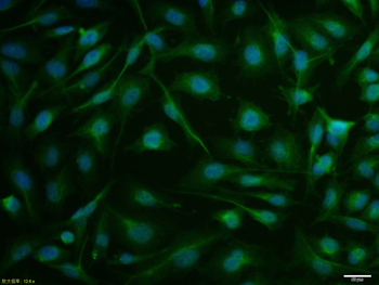 Phospho-Estrogen Receptor alpha (Ser167) Rabbit Polyclonal Antibody