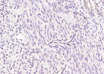 Phospho-Estrogen Receptor alpha (Ser167) Rabbit Polyclonal Antibody