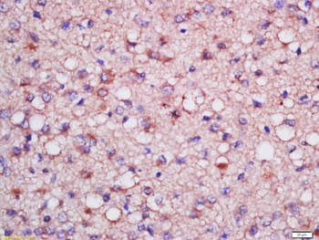 FABP7 Rabbit Polyclonal Antibody
