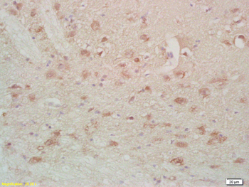 FABP7 Rabbit Polyclonal Antibody