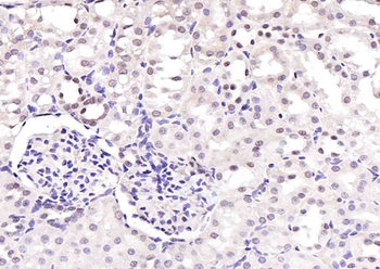 GATA5 Rabbit Polyclonal Antibody