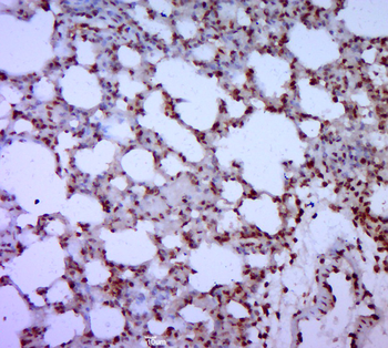 GATA5 Rabbit Polyclonal Antibody