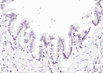 GATA5 Rabbit Polyclonal Antibody