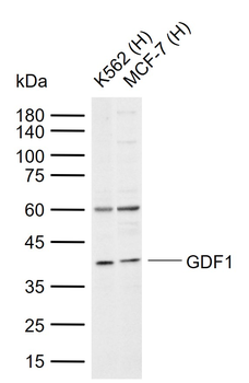 GDF1 Rabbit Polyclonal Antibody