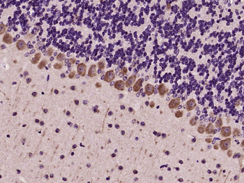 GRM1 Rabbit Polyclonal Antibody