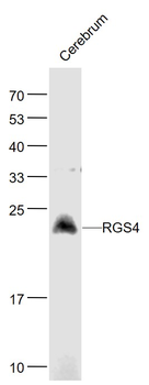 RGS4 Rabbit Polyclonal Antibody