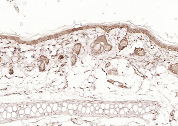 HDAC2 Rabbit Polyclonal Antibody