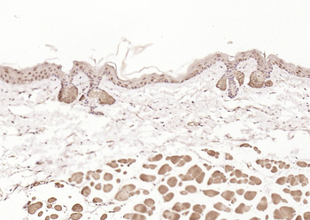 HDAC2 Rabbit Polyclonal Antibody