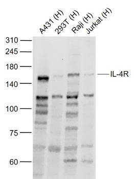 IL4 Receptor antibody