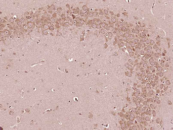 IL-6R alpha Rabbit Polyclonal Antibody