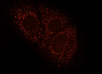 Mitofilin Rabbit Polyclonal Antibody