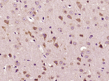 Mitofilin Rabbit Polyclonal Antibody