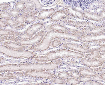 Mitofilin Rabbit Polyclonal Antibody