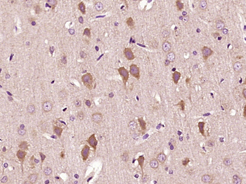 Mitofilin Rabbit Polyclonal Antibody