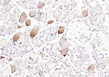 SLC2A4RG Rabbit Polyclonal Antibody